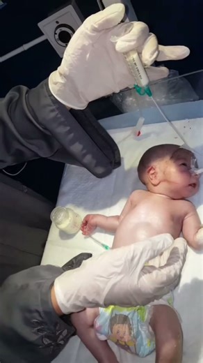 NG feeling #newbornbaby #nicu