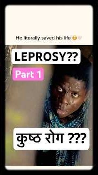 Leprosy: A disease older than history itself… #doctor #facts #leprosy