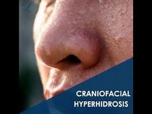 Craniofacial Hyperhidrosis (Excessive Sweating of Head and Face); Causes, Symptoms, Diagnosis, Treat