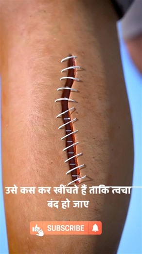 how stitchticks work 😱 #stitchtricks #shorts