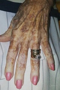 Nurse takes photo of old lady's hand – then sees detail in the picture that has the internet exploding.... Check comments 👇🏻👀 | Great Creation