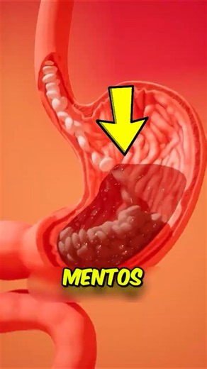What Happens If You Swallow Coke & Mentos? The Truth Is Worse Than You Think! 😱