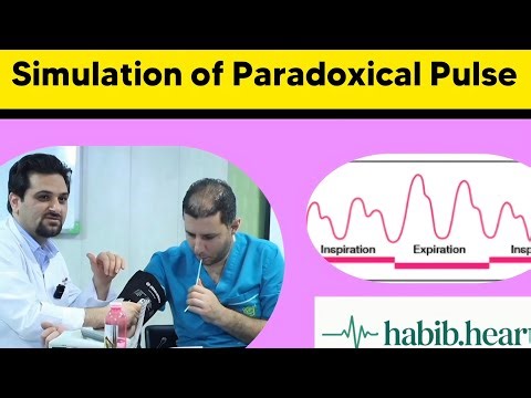 Simulating Paradoxical Pulse in COPD Using a Simple Straw – A Bedside Teaching Trick!
