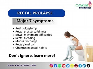 Rectal Prolapse: Understanding, Symptoms, and Treatment Options