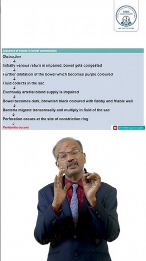 Strangulated Inguinal Hernia | Part 3 | Dr. SRB