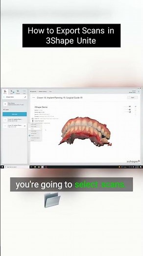 How to Export Scans in 3Shape Unite #dentallab #3shape #dentallab #digitaldentistry #exocad