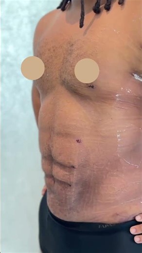 Sculpting the Masterpiece: A High-Definition Body Evolution by Dr. David Cong