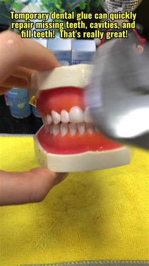 Temporary Dental Adhesive for At-Home Tooth Repair