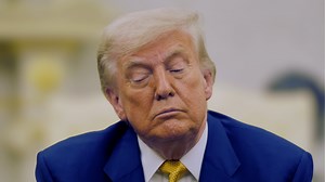 Donald Trump diagnosed with chronic venous insufficiency after leg swelling, White House reveals