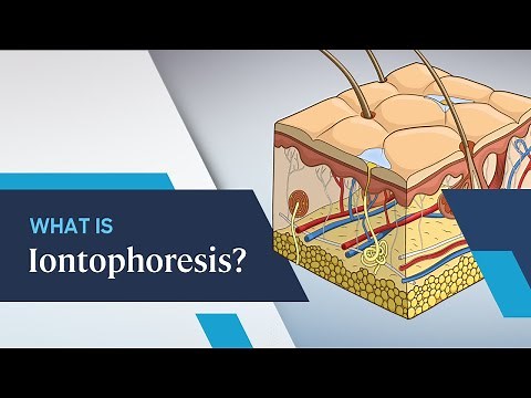 What is Iontophoresis?