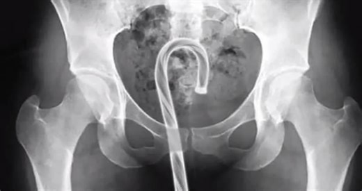 X-rays of foreign objects.