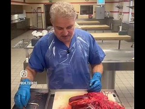 Video-Tutorial: so präparierst du die Gallenblase