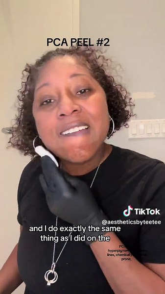 PCA Peel #2 in a series to rid my skin of fine lines and hyperpigmentation also great for acne prone skin. #skincare #healthy #fyp #dallas #acne #fineline #beauty #hyperpigmentation #antiaging
