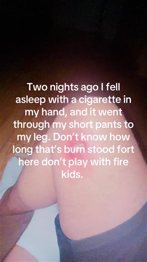 Cigarette Safety Tips: Avoiding Fire Hazards