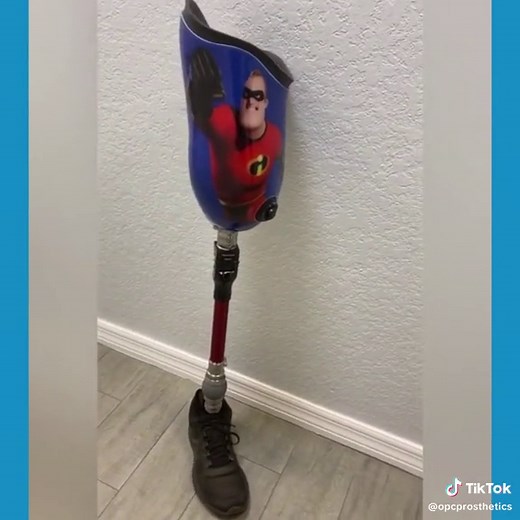 Here is a custom AK, above the knee prosthesis with a Blatchford BMK2 knee and an Ossur balance S foot, on a custom suction socket Want to know more about OPC? Message us now! #prosthetic #prosthesis #bts #behindthescene #weareopc #opc #iamopc #orthoticsandprosthetics #amputee #amputeestrong #amputeesupport #prosthetics #orthotic #patientcare #opcenter #amputeecare