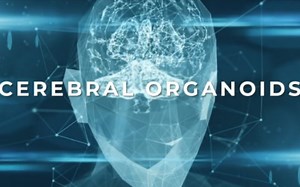 【中英字幕】脑类器官（迷你大脑）organoids-mini brain