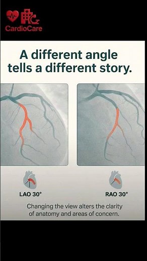 CAth Lab Coronary View in Different angle #cardiocare #cathlab