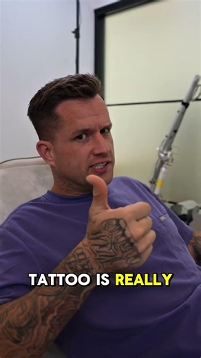 Common MYTHS Of Tattoo Removal