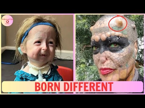 20 Unique People Born Different – Truly One in a Million