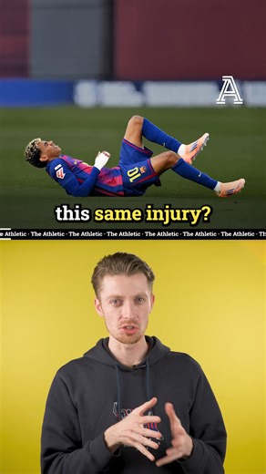 The Athletic | Football on Instagram: "Lamine Yamal & Cole Palmer have both suffered pubalgia injuries. What is it, and why is it affecting young wingers?"