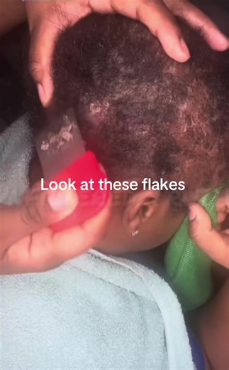 Only part. No audio, just flakes. Reposted from Unfiltered Truths on Facebook. #asmrvideo #satisfiedscratch4 #relax #satisfying #fyp