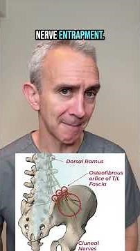 3 Weird Nerve Pains