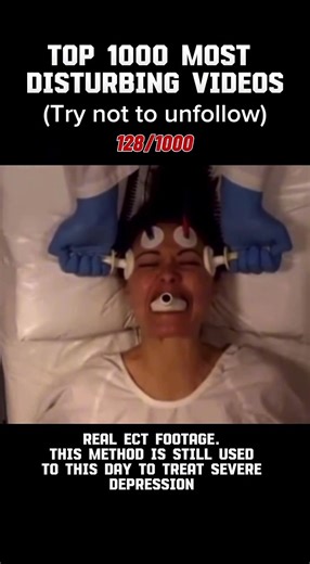 This method is still used today to treat severe depression