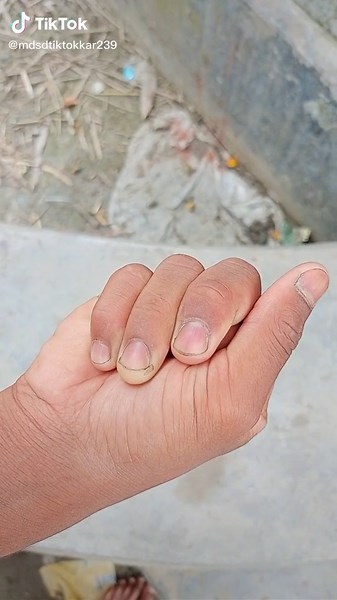 Close-Up Exploration of Human Hand Features