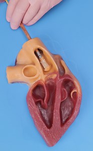 73K views · 317 reactions | How Body Surgery Is Done: Clear Examples for Better Understanding | Green Bean | Facebook