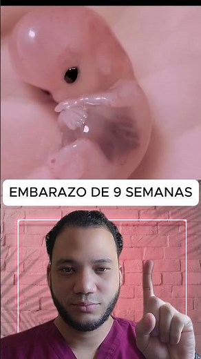Así se ve tu bebé a las 9 semanas de embarazo