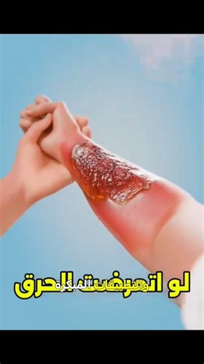 فكرة بسيطة غيّرت الطب 💡🐟#غرائب_الطب#حقائق_علمية#معلومات_مذهلة