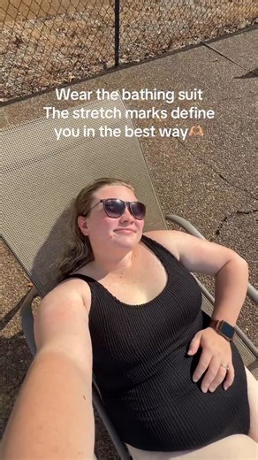 Alexis Mae Dennis on Instagram: "My body has done so many incredible things in the last 4 years! I’m covered in stretch marks but they are simple reminders of what my body did to have my boys here with me! We all are beautifully made in different ways!! Some days are hard living with how my body is but I’m growing everyday closer to being confident in how I look as a mom 🥰🥹#mom #confidence #selflove #bodypositivity #stretchmarks #leximaedennis #relatable #boymom"