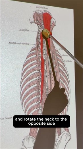 Semispinalis Cervicis #anatomy #anatomyshorts #kinesiology #muscleoftheday