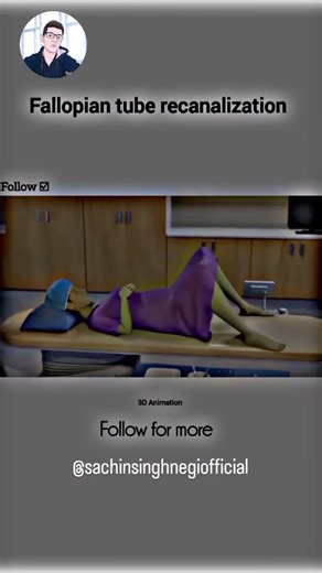 Sachin Singh Negi | Fallopian tube recanalization Process in 3d animation it's reels for education purpose only ❤️‍🩹👍 #twins #medstudents #viral #trending... | Instagram