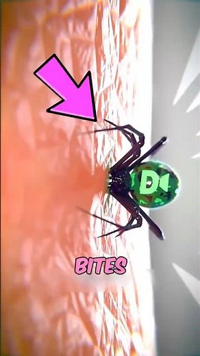 If You Ever Get Bitten by a Spider, Do This Immediately 😱