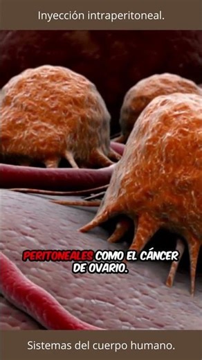 💉 Intraperitoneal injection: what you should know about this medical technique