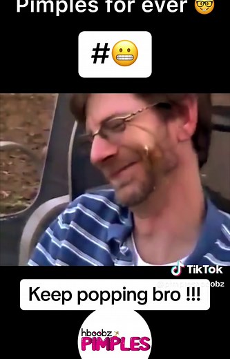 Ultimate Pimple Popping Compilation