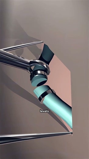 Vasectomy Birth Control Procedure (3D Animation) #drone #theflash #space #automobile #scifi #doctor