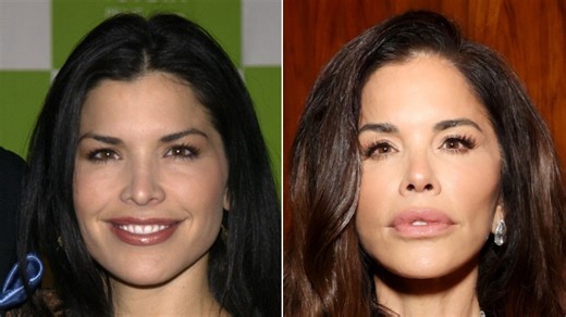 Lauren Sánchez Bezos' rumored plastic surgery is beyond obvious in side-by-side pics