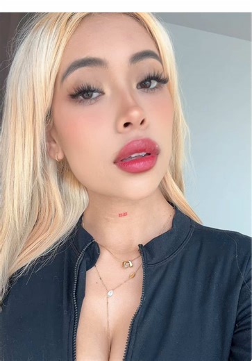 Me caí de cara y ahora tengo un morete en mi frente:(