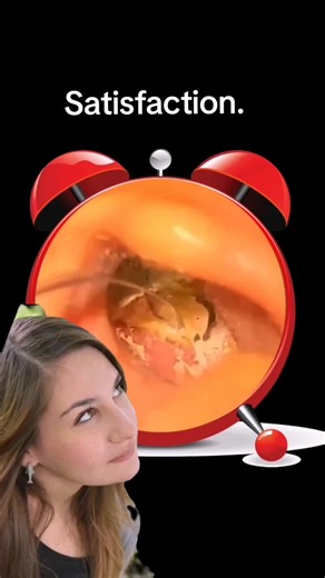 Effective Ear Cleaning Techniques for Earwax Removal