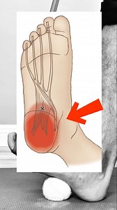 2.1M views · 21K reactions | Yurii Zozulia-Physiotherapy on Reels | Facebook