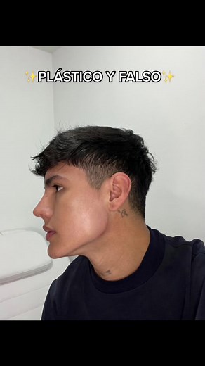 Chin Filler Procedure: Results and Experience