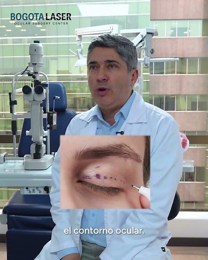 Blefaroplastia: qué esperar y cómo cuidar tu recuperación