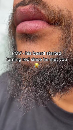 Ginger Beard Transformation: Why Do Beards Turn Red?