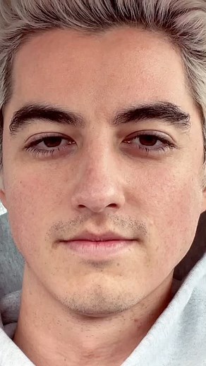 Close-Up Portrait Focused on Unique Facial Features