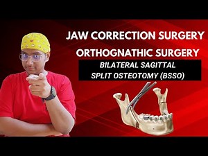 Dr Rudra Mohan |Bilateral Sagittal Split Osteotomy (BSSO) | Jaw Correction Orthognathic Surgery