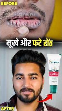 Himalaya Lip Balm Review 😍 Soft Pink Lips in Days? 💋 #Shorts