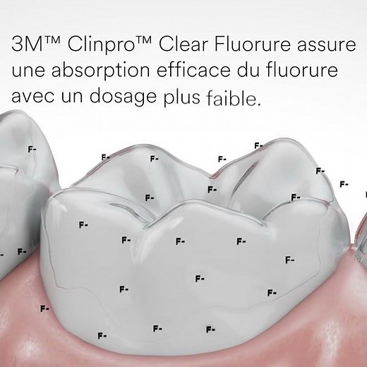 Solventum 3M Clinpro Clear Fluorure – Protection Dentaire Invisible et Performante 2025