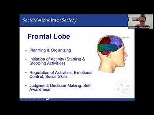 Brain Changes in Dementia
